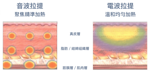 電波音波差別示意圖,了解電波與音波的不同原理,幫助快速理解。