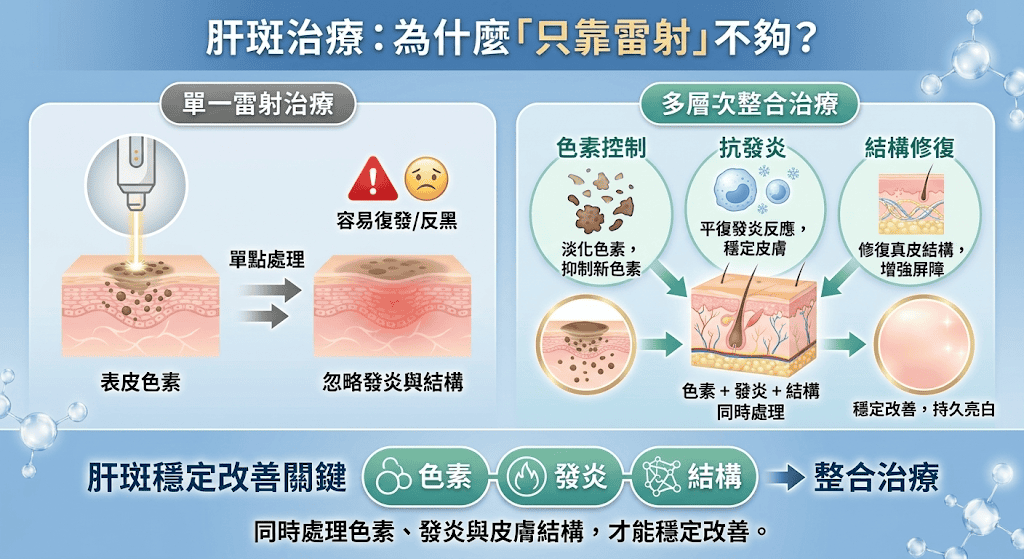 肝斑治療需同時處理色素、發炎與皮膚結構，才能穩定改善